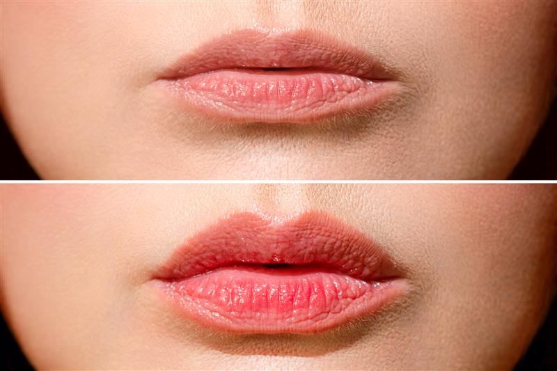A woman 's lips before and after using lip balm.