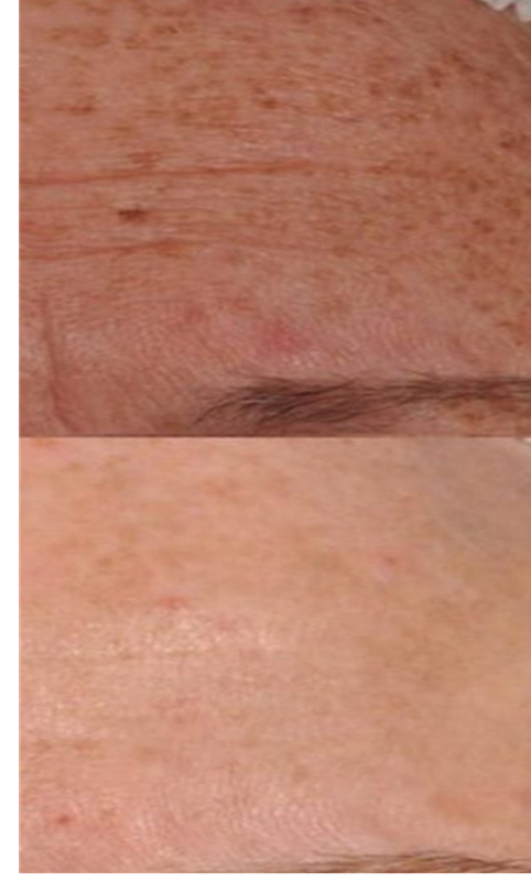 A close up of the skin on someone 's face
